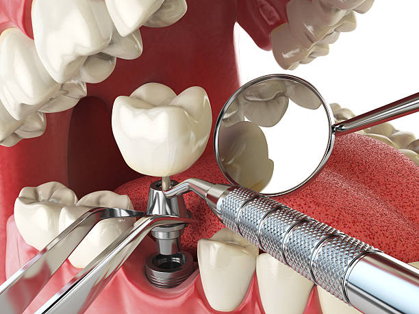 Best Root Canal Emergency Dentist  in Canton, PA